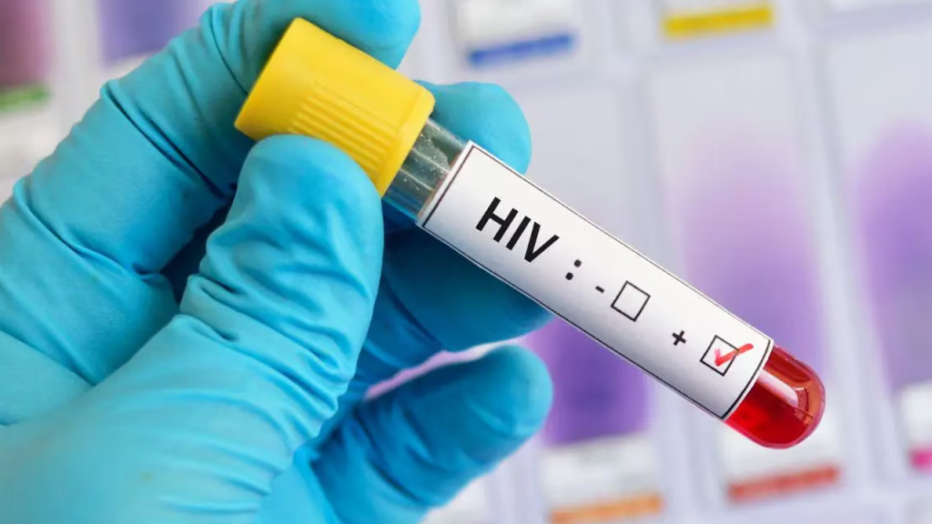 Se reportan 498 nuevos casos de VIH en El Salvador