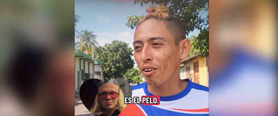 Usuluteco afirma que es el «Haaland salvadoreño» por su cabello