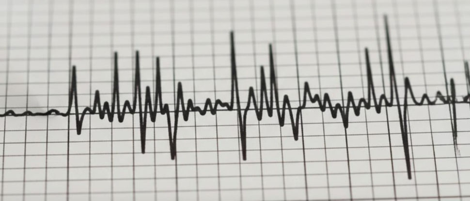 Terremoto de magnitud 7,2 sacude a Perú