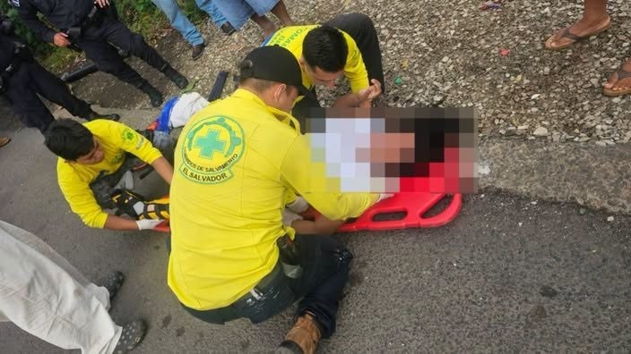 Muchacha sufre fractura expuesta tras caerle una pieza que se desprendió en un camión